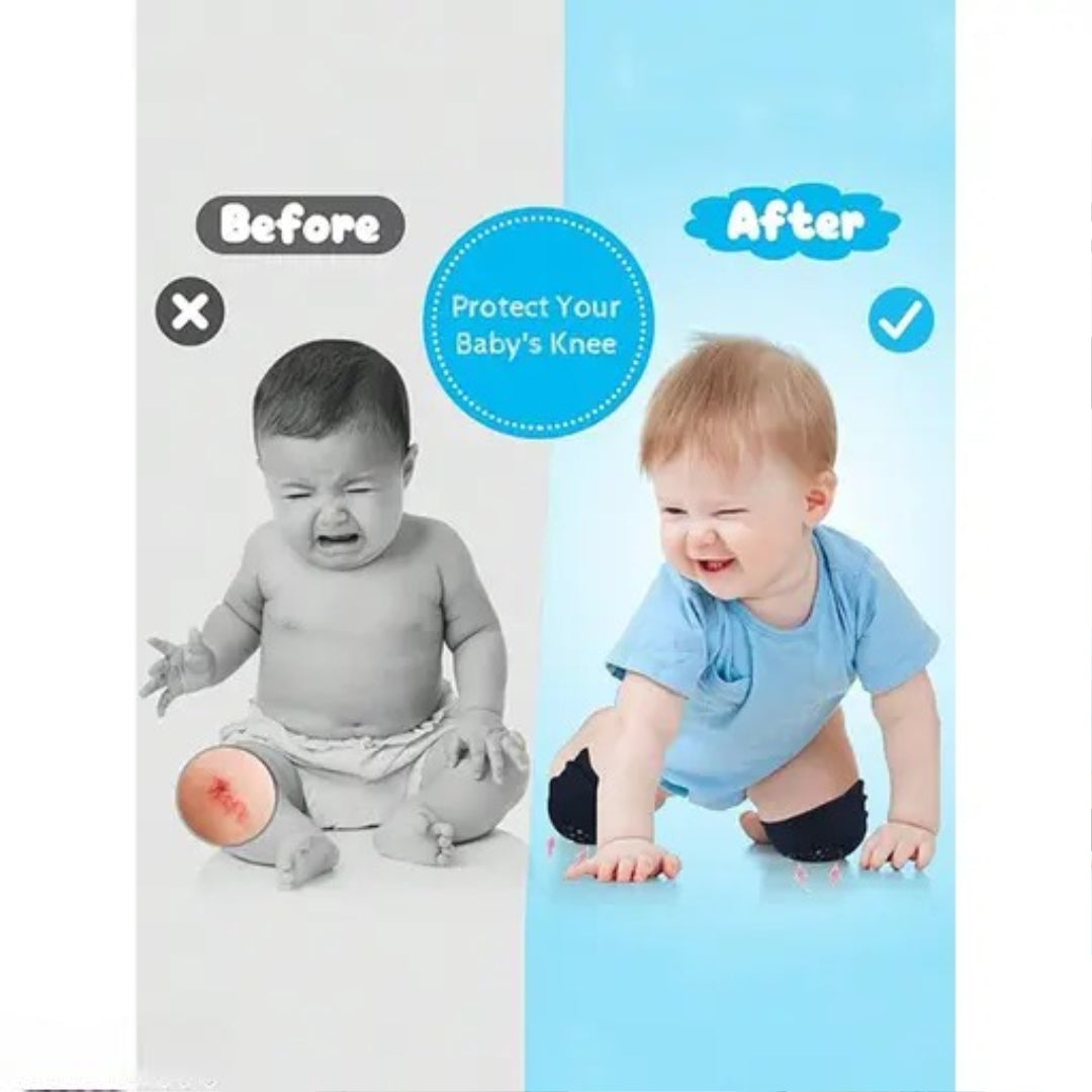 LEAPABLE ENTERPRISE 2 Pairs Smiley Baby Knee pads for Crawling, Anti-Slip Padded Stretchable Elastic Cotton Soft Breathable Comfortable Knee Cap Elbow Safety Protector Multicolor Baby Knee Pads Other Kids Smiley